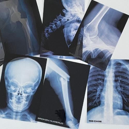 洋書【解剖学・骨格がわかる】レントゲン遊び　AMAZING X-RAYS　人体