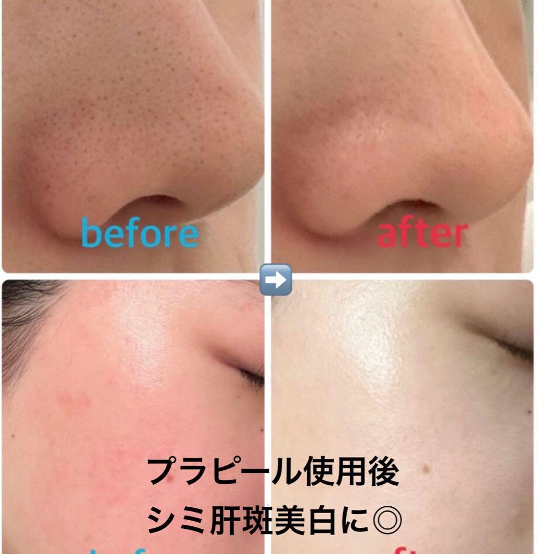 【複数割お値下げ◎】プラピール【9回分】11,300円 リピ割更に300円off