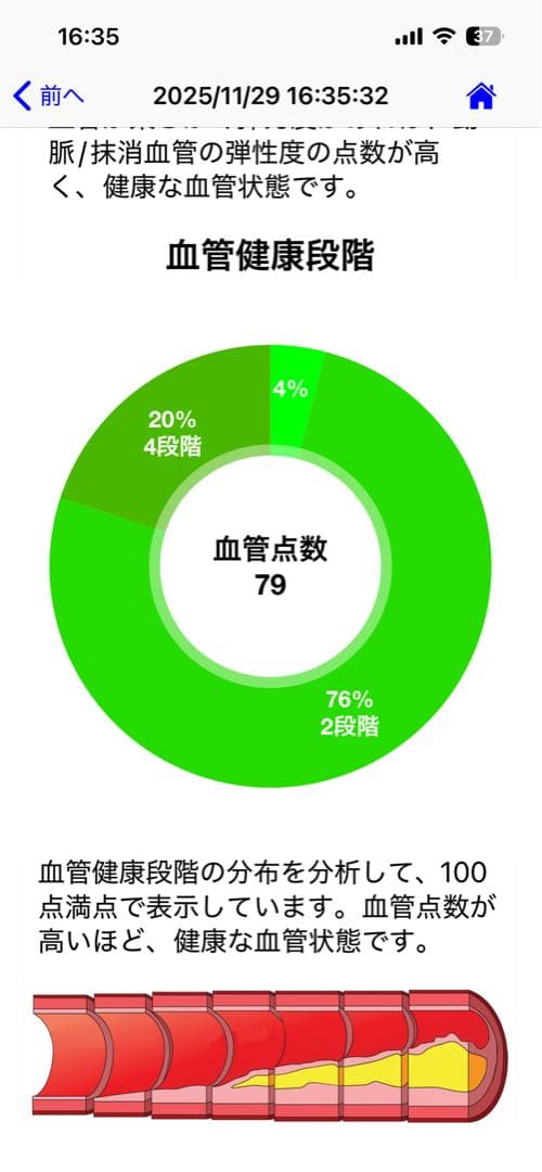 Smart Pulse（スマートパルス）